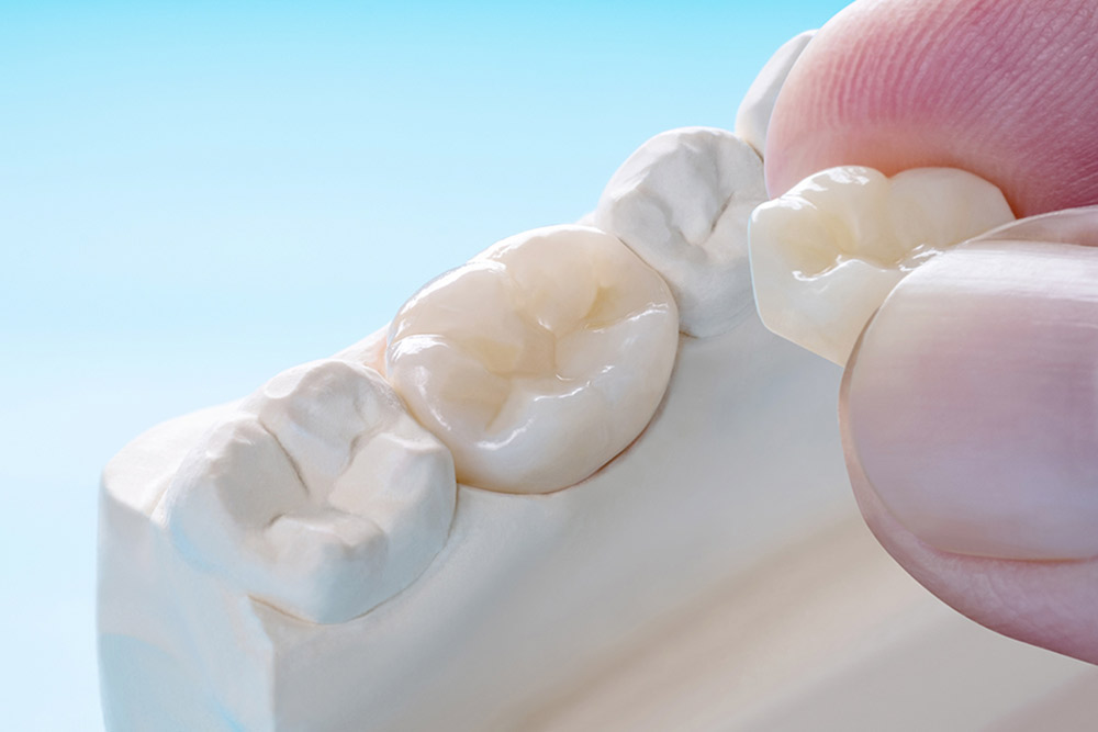 つめ物・かぶせ物とは